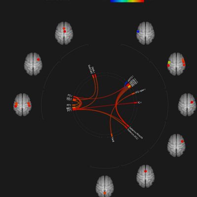 brain shots brain shots