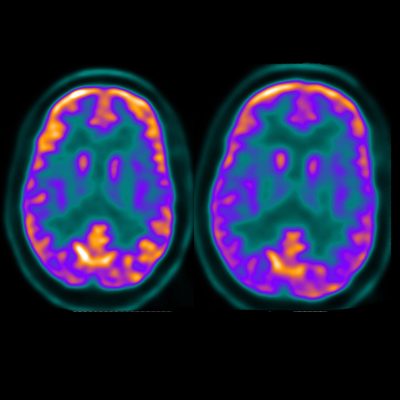 fmri fmri